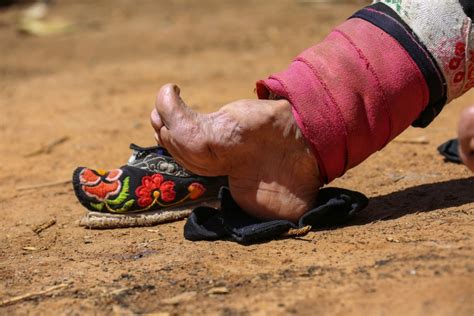 what are bound feet in china
